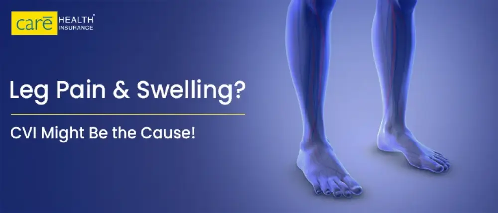 Swollen Legs? It Could Be Chronic Venous Insufficiency