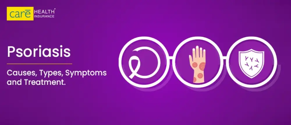 Demystifying Psoriasis: Causes, Symptoms, and Therapies