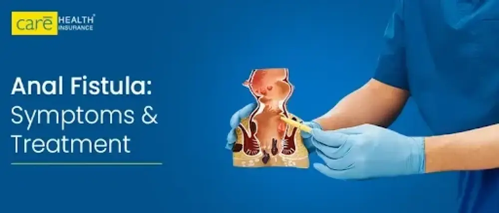 Living with Anal Fistula: Causes & Symptoms