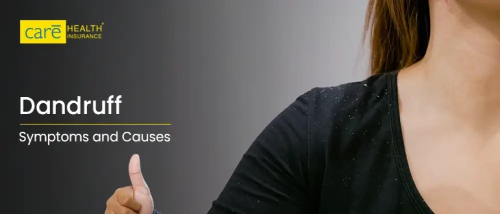 What are Dandruff Symptoms and Their Causes?