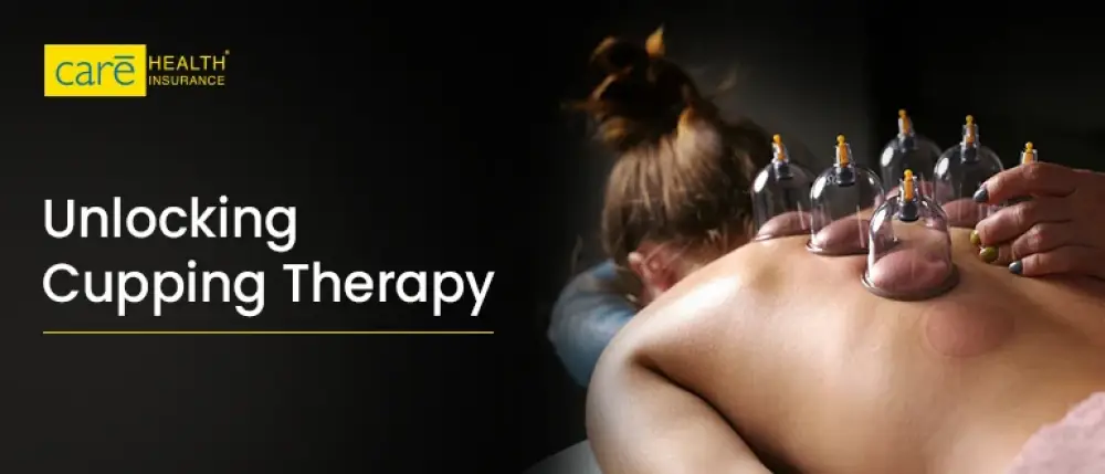 A Complete Guide to Understanding  Cupping Therapy