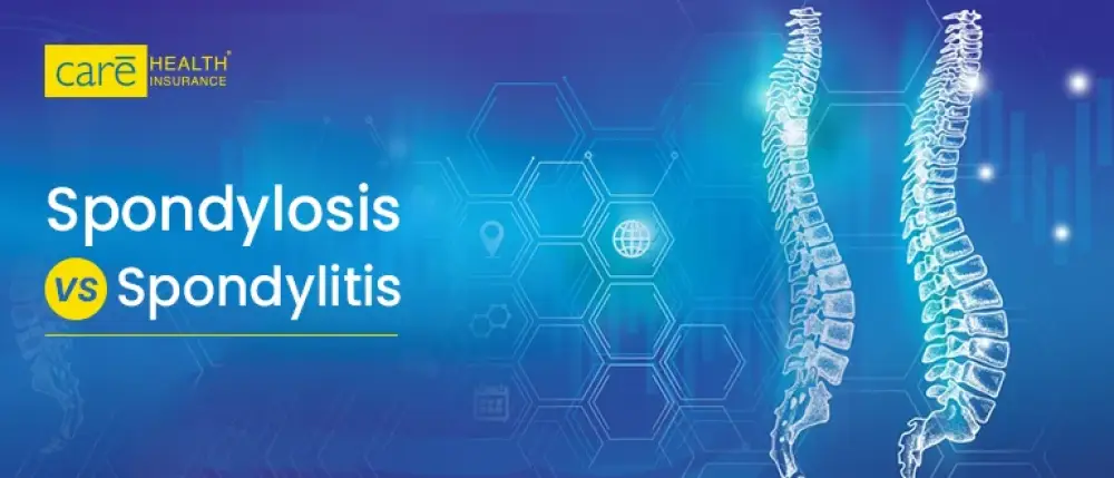 Spondylosis vs. Spondylitis: Understanding the Difference and Key Causes