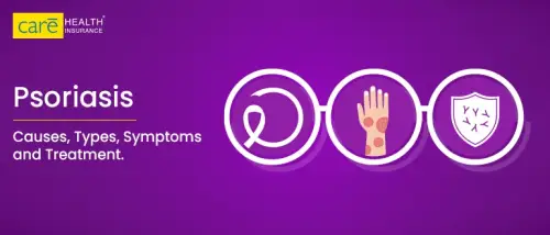 Demystifying Psoriasis: Causes, Symptoms, and Therapies