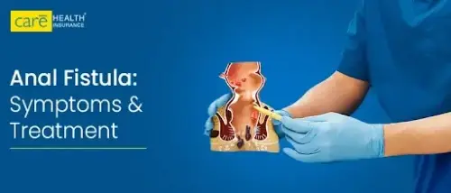 Living with Anal Fistula: Causes & Symptoms