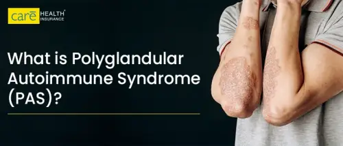 What is Polyglandular Autoimmune Syndrome (PAS)?