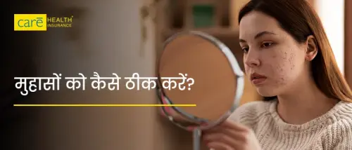 चेहरे पर पिंपल्स क्यों होते हैं? जानें इसका इलाज कैसे करें? चेहरे पर पिंपल्स क्यों होते हैं? जानें इसका इलाज कैसे करें?