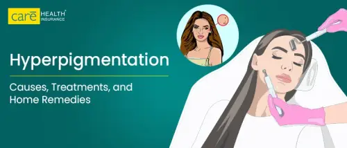 Hyperpigmentation: A Complete Guide to Its Causes & Treatment