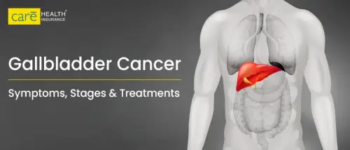 Early Warning Signs of Gallbladder Cancer You Shouldn't Ignore!