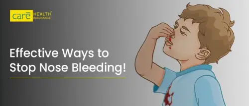 How to Stop a Bloody Nose? Easy Ways for Quick Relief!