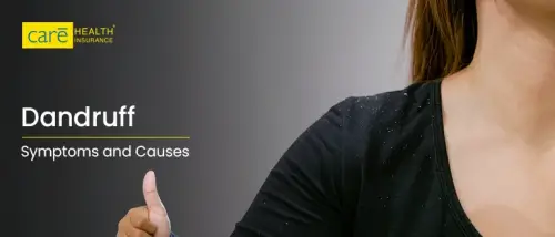 What are Dandruff Symptoms and Their Causes? What are Dandruff Symptoms and Their Causes?