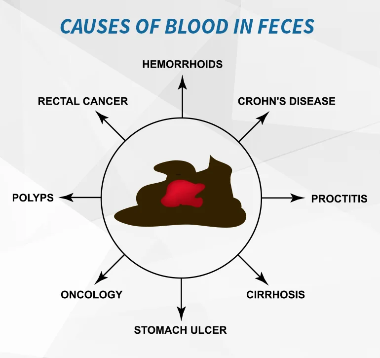 When to Worry about Blood in Stool?