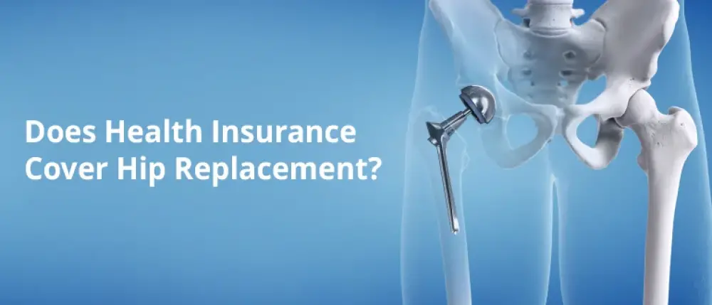 Does Health Insurance Cover Hip Replacement?