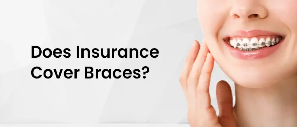 Does Your Health Insurance Cover Braces?
