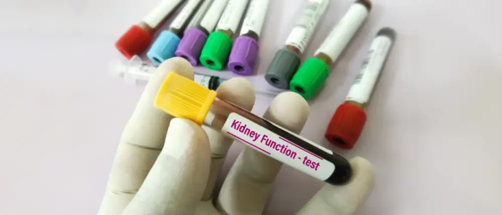 What are Kidney Function Tests?