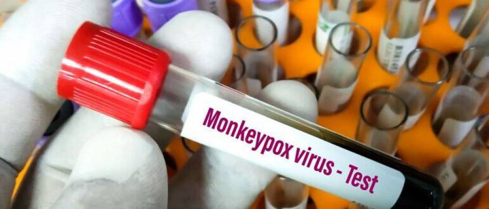 Here is Everything You Need to Know About Monkeypox