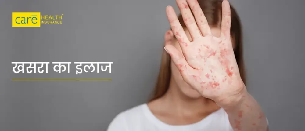 खसरे का टीका किस आयु में लगता है? देखें, खसरा के लक्षण