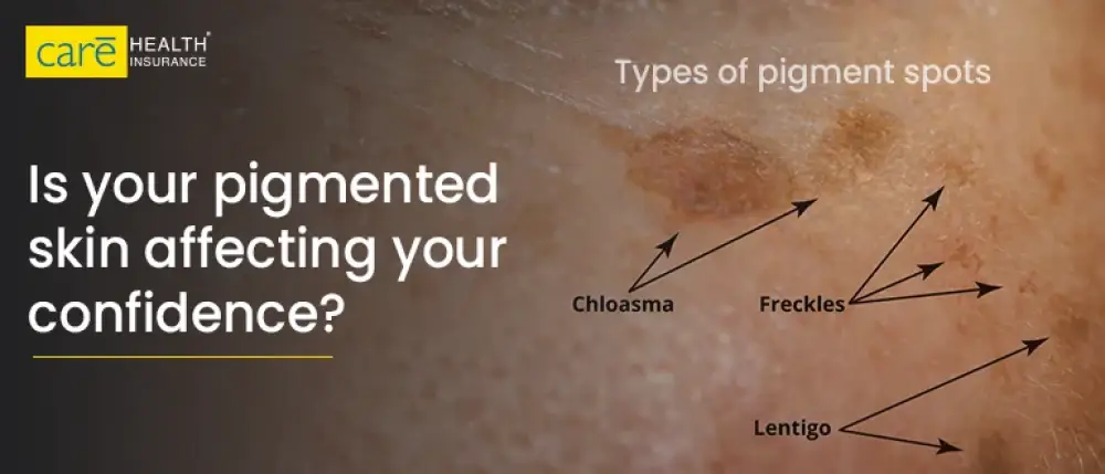Can Skin Pigmentation Be Permanently Cured? Key Facts You Should Know
