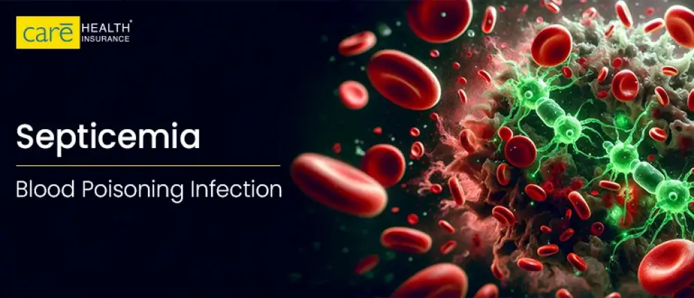 Septicemia Meaning & Warning Signs That You Must Know!