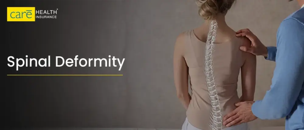 Understanding Congenital Kyphosis: Types and Their Impact