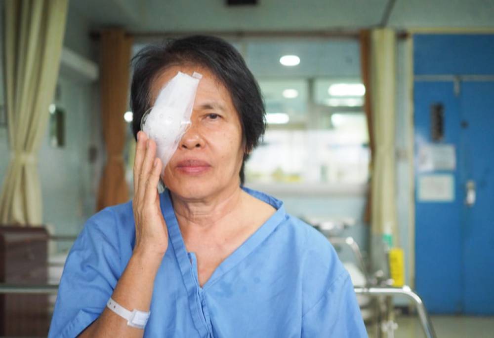 need of health insurance for cataract surgery