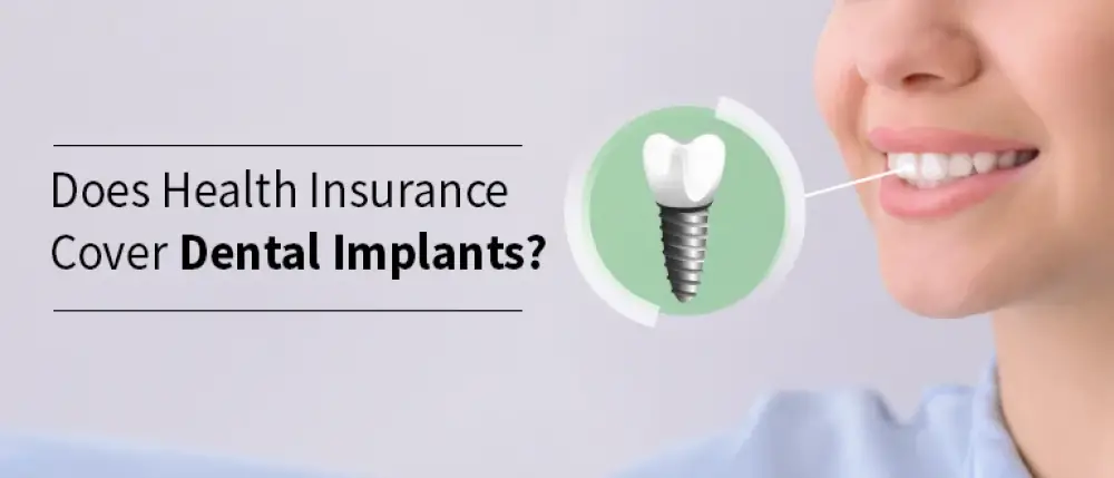 Does Health Insurance Cover Dental Implants?