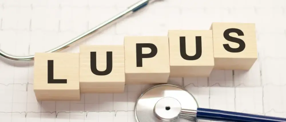 10 Early Signs of Lupus You must Not Ignore