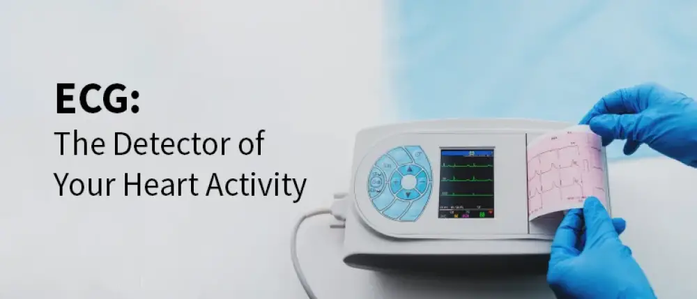 ECG: The Detector of Your Heart Activity