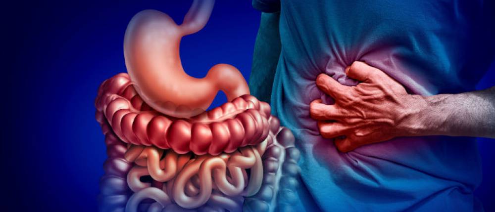 Causes, Symptoms, and Treatment of Crohn's Disease