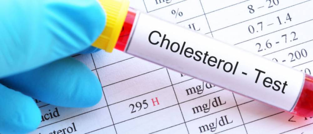 हाई कोलेस्ट्रॉल के लक्षण क्या है? देखें, कोलेस्ट्रॉल कम करने के घरेलू उपाय
