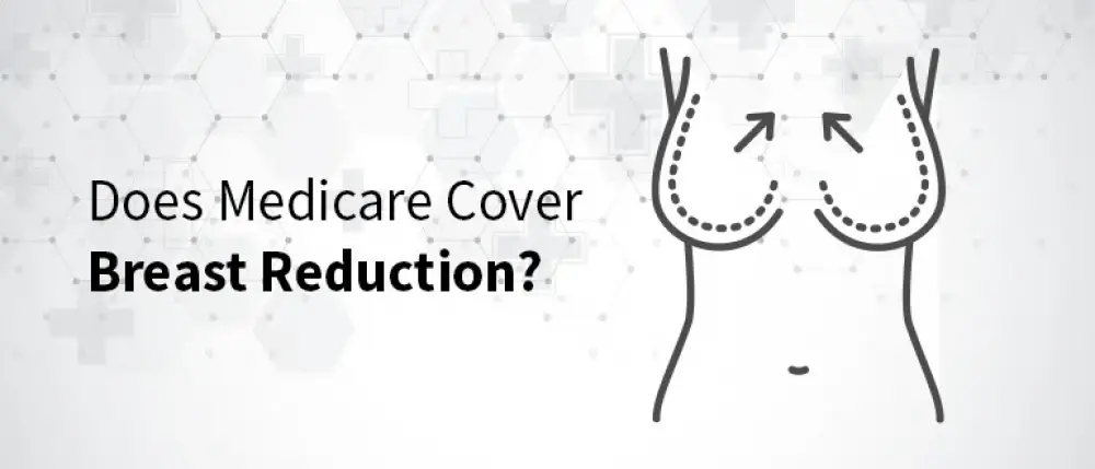 Does Medicare Cover Breast Reduction?