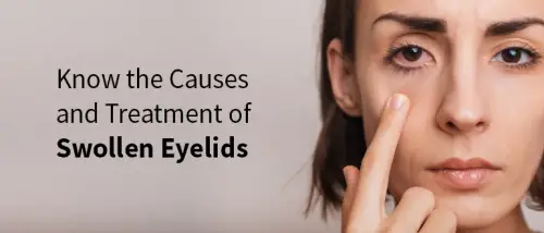 Know the Causes and Treatment of Swollen Eyelids