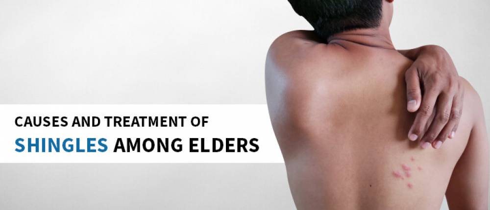 Causes and Treatment of Shingles Among Elders in India