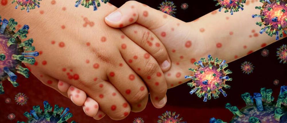 7 Most Communicable Diseases in India You Must Know About
