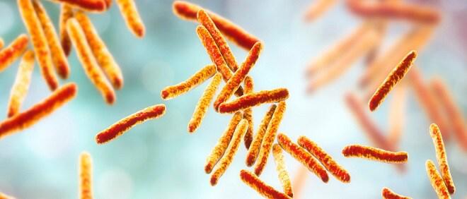 Tuberculosis tuberculosis