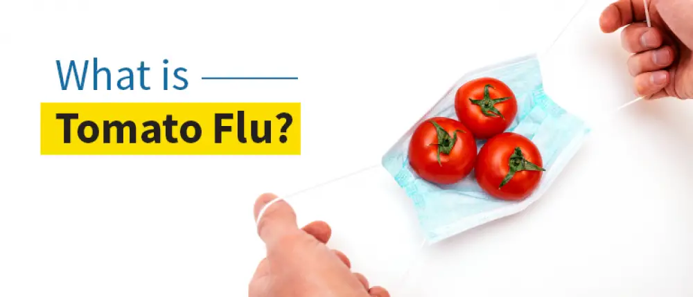 What is Tomato Flu? Its Symptoms, Causes, Prevention