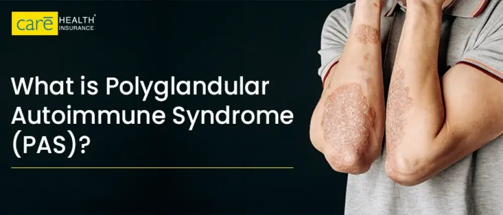 What is Polyglandular Autoimmune Syndrome (PAS)?