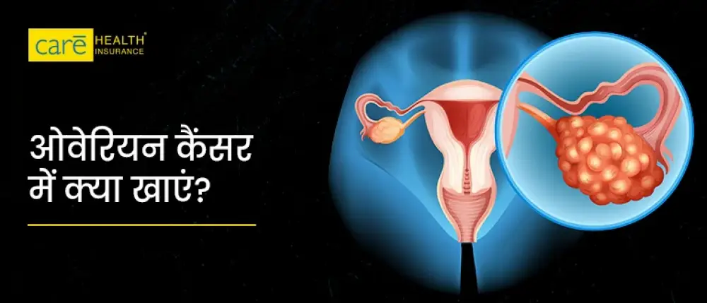 ओवेरियन कैंसर क्या है? जानें कारण, लक्षण और उपचार ओवेरियन कैंसर क्या है? जानें कारण, लक्षण और उपचार