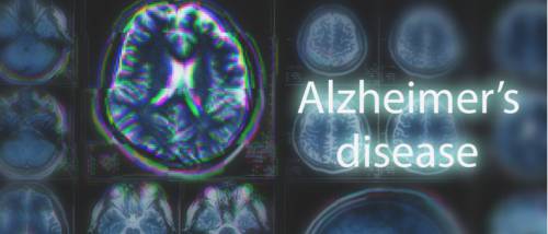 How to Take Care of your Parents Suffering from Alzheimer's Disease