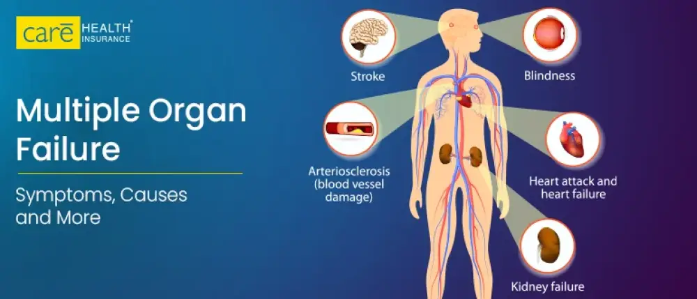 What is Multiple Organ Failure?
