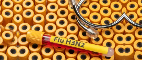 influenza virus symptoms causes and treatment in hindi