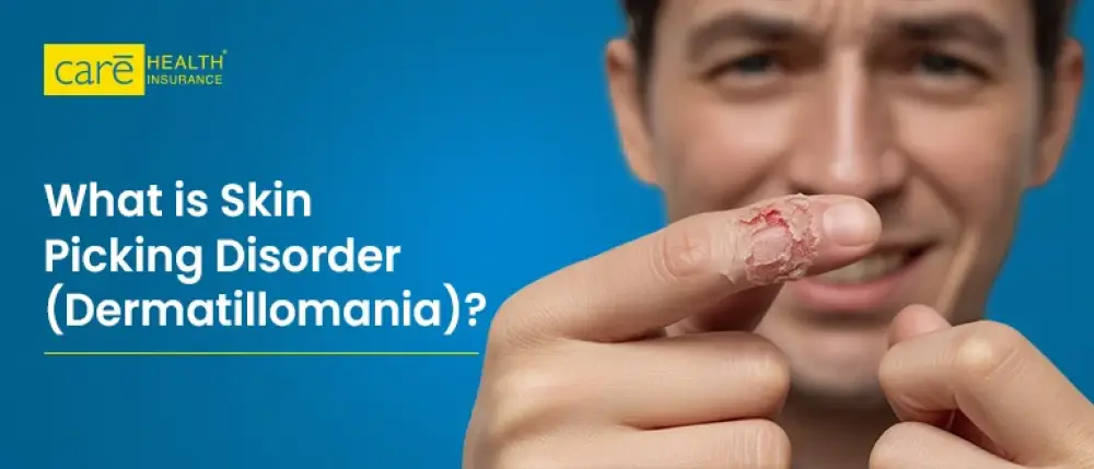Skin Picking Disorder (Dermatillomania): A Complete Guide