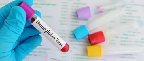 how much hemoglobin should be know how to increase it