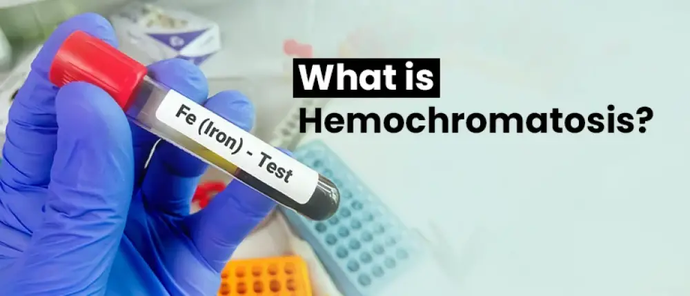 Hemochromatosis: Symptoms, Causes & Treatment