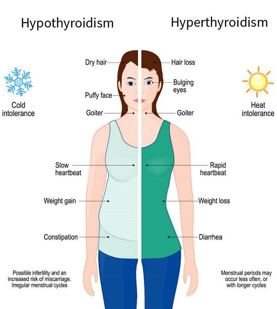 thyroid glands disorder