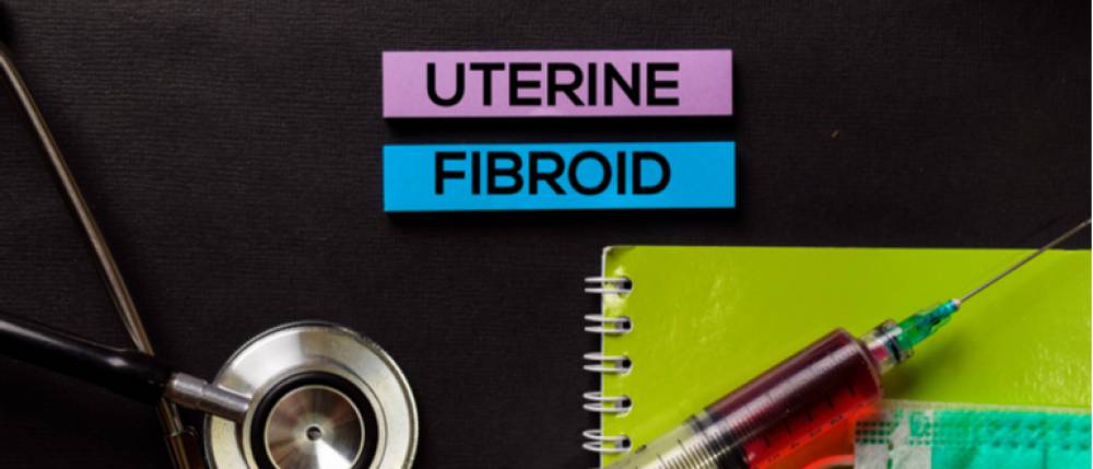 uterine fibroids here s what women should know about its causes and treatment
