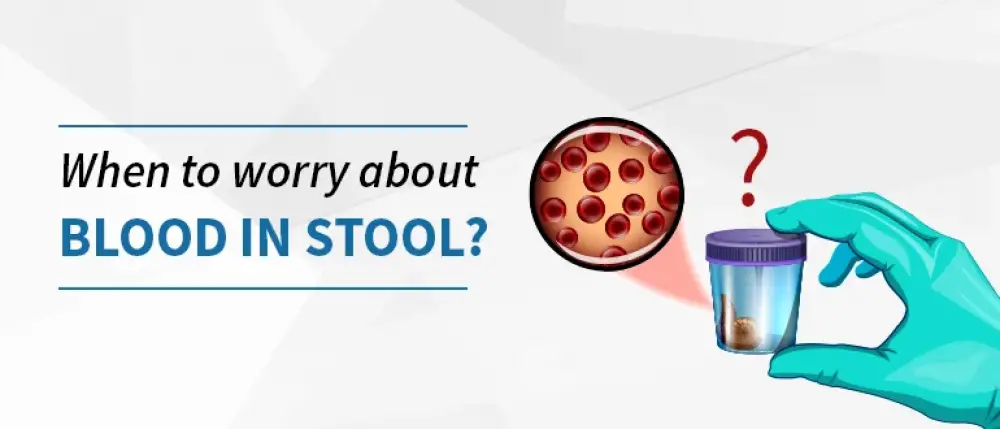 Blood in Stools: Does it Hint at a Serious Health Problem?