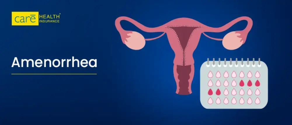 Amenorrhea: When Missing Periods Become a Medical Concern