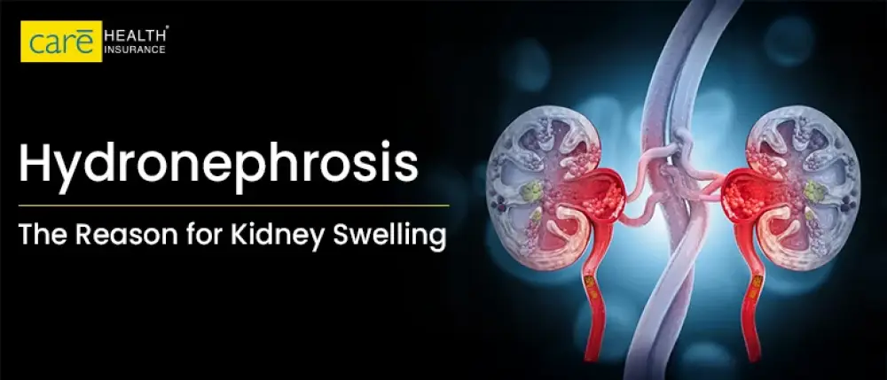 Are Your Kidneys in Danger? Early Signs of Mild Hydronephrosis!