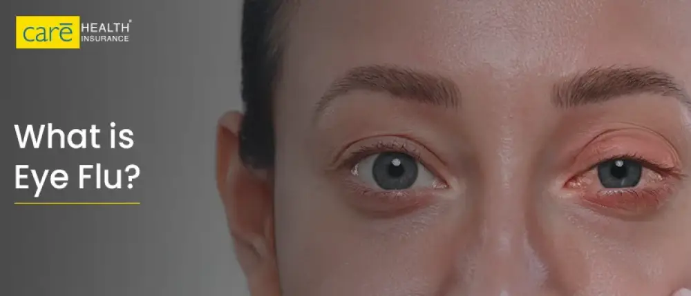 Eye Flu: Warning Signs, Causes & Fast Relief Remedies