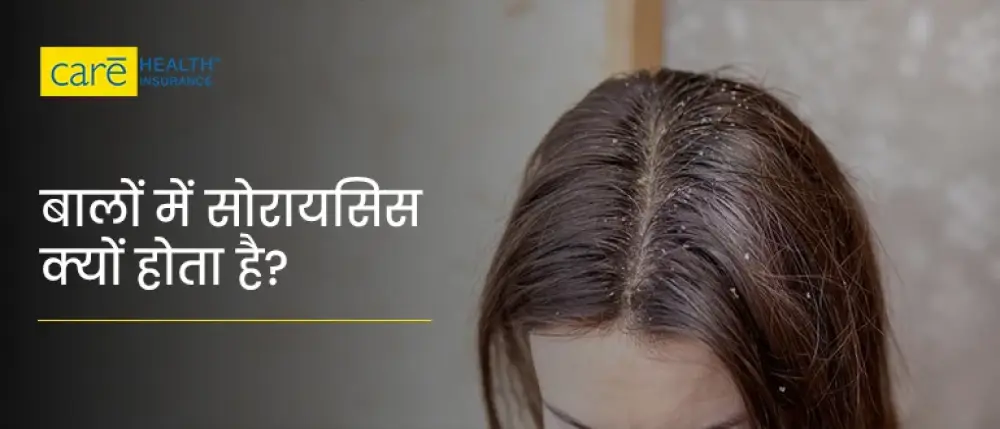 स्कैल्प सोरायसिस क्यों होता है? जानें क्या खाएं और क्या न खाएं?